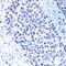 Methyltransferase Like 3 antibody, GTX33315, GeneTex, Immunohistochemistry paraffin image 
