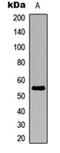 Aldehyde Dehydrogenase 1 Family Member A2 antibody, orb235005, Biorbyt, Western Blot image 