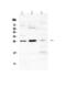 Fms Related Tyrosine Kinase 3 Ligand antibody, PA5-79274, Invitrogen Antibodies, Western Blot image 