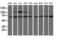 Proteasome 26S Subunit, Non-ATPase 3 antibody, LS-C173767, Lifespan Biosciences, Western Blot image 