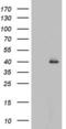 Histone deacetylase 11 antibody, LS-C798161, Lifespan Biosciences, Western Blot image 