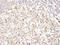 Chromatin Assembly Factor 1 Subunit A antibody, NB100-74608, Novus Biologicals, Immunohistochemistry paraffin image 