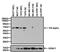 Estrogen Receptor 2 antibody, MA5-13304, Invitrogen Antibodies, Western Blot image 