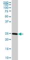 RAB27A, Member RAS Oncogene Family antibody, H00005873-M01, Novus Biologicals, Western Blot image 