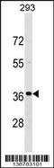 Troponin T3, Fast Skeletal Type antibody, 58-881, ProSci, Western Blot image 