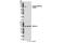 ALK Receptor Tyrosine Kinase antibody, 14678S, Cell Signaling Technology, Western Blot image 