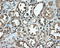MCL1 Apoptosis Regulator, BCL2 Family Member antibody, LS-C115040, Lifespan Biosciences, Immunohistochemistry paraffin image 