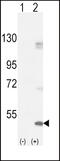 Fibroblast Growth Factor Receptor 1 antibody, 63-083, ProSci, Western Blot image 