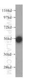 Enhancer Of MRNA Decapping 3 antibody, 16486-1-AP, Proteintech Group, Western Blot image 