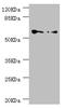 Chaperonin Containing TCP1 Subunit 5 antibody, LS-C675475, Lifespan Biosciences, Western Blot image 