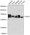 Desmoglein 2 antibody, GTX64551, GeneTex, Western Blot image 