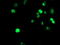 Methyltransferase Like 16 antibody, TA504710, Origene, Immunofluorescence image 