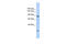 Cell Division Cycle 5 Like antibody, 25-602, ProSci, Enzyme Linked Immunosorbent Assay image 