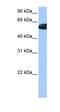 NOVA Alternative Splicing Regulator 1 antibody, orb330128, Biorbyt, Western Blot image 