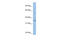 Potassium Channel Tetramerization Domain Containing 4 antibody, 25-376, ProSci, Western Blot image 