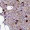 Sphingomyelin phosphodiesterase 4 antibody, NBP2-33460, Novus Biologicals, Western Blot image 