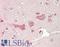 MYCN Proto-Oncogene, BHLH Transcription Factor antibody, LS-B13751, Lifespan Biosciences, Immunohistochemistry paraffin image 
