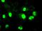 Neurogenin 1 antibody, GTX84051, GeneTex, Immunocytochemistry image 