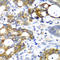 Pancreatic alpha-amylase antibody, A06771, Boster Biological Technology, Immunohistochemistry paraffin image 