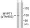 Protein Phosphatase 1 Regulatory Subunit 12A antibody, PA5-38299, Invitrogen Antibodies, Western Blot image 