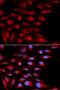 Alpha-2-Glycoprotein 1, Zinc-Binding antibody, LS-C335565, Lifespan Biosciences, Immunofluorescence image 