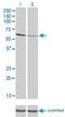 RIO Kinase 3 antibody, H00008780-M02, Novus Biologicals, Western Blot image 