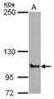 ATP Binding Cassette Subfamily F Member 1 antibody, NBP2-15226, Novus Biologicals, Western Blot image 