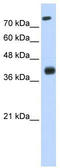 ISL LIM Homeobox 2 antibody, TA345529, Origene, Western Blot image 