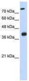 Insulin gene enhancer protein ISL-2 antibody, TA345529, Origene, Western Blot image 