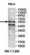 Zinc Finger Protein 83 antibody, orb78303, Biorbyt, Western Blot image 