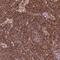 Ras Association Domain Family Member 5 antibody, NBP2-57516, Novus Biologicals, Immunohistochemistry paraffin image 