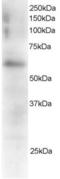 FGR Proto-Oncogene, Src Family Tyrosine Kinase antibody, EB05218, Everest Biotech, Western Blot image 