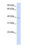 GTP Binding Protein 10 antibody, NBP1-52959, Novus Biologicals, Western Blot image 