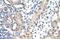 Small Nuclear Ribonucleoprotein D1 Polypeptide antibody, PA5-41828, Invitrogen Antibodies, Immunohistochemistry frozen image 
