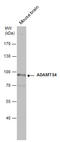 ADAM Metallopeptidase With Thrombospondin Type 1 Motif 4 antibody, GTX105125, GeneTex, Western Blot image 