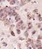 Serine/threonine-protein kinase PINK1, mitochondrial antibody, PA5-23072, Invitrogen Antibodies, Immunohistochemistry frozen image 