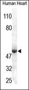 Solute Carrier Family 2 Member 1 antibody, 252214, Abbiotec, Immunohistochemistry paraffin image 