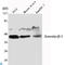Arrestin Beta 1 antibody, LS-C814093, Lifespan Biosciences, Western Blot image 