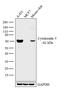Keratin 5 antibody, MA5-14473, Invitrogen Antibodies, Western Blot image 