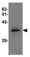 Musashi RNA Binding Protein 2 antibody, GTX31838, GeneTex, Western Blot image 