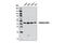 Vacuole Membrane Protein 1 antibody, 12978S, Cell Signaling Technology, Western Blot image 