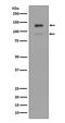 Interferon Alpha And Beta Receptor Subunit 1 antibody, M00306-1, Boster Biological Technology, Western Blot image 