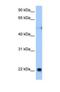 Reticulon 4 antibody, NBP1-69284, Novus Biologicals, Western Blot image 