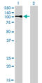 Low Density Lipoprotein Receptor antibody, LS-C197609, Lifespan Biosciences, Western Blot image 