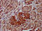 ADAM Metallopeptidase Domain 8 antibody, CSB-PA10259A0Rb, Cusabio, Immunohistochemistry paraffin image 