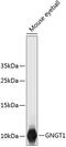 G Protein Subunit Gamma Transducin 1 antibody, 19-198, ProSci, Western Blot image 