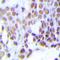 Checkpoint Kinase 1 antibody, orb338872, Biorbyt, Immunohistochemistry paraffin image 