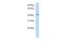 RBM22 antibody, GTX47286, GeneTex, Western Blot image 