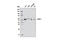 ETS Proto-Oncogene 1, Transcription Factor antibody, 6258S, Cell Signaling Technology, Western Blot image 