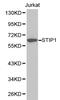 Stress Induced Phosphoprotein 1 antibody, A02683, Boster Biological Technology, Western Blot image 